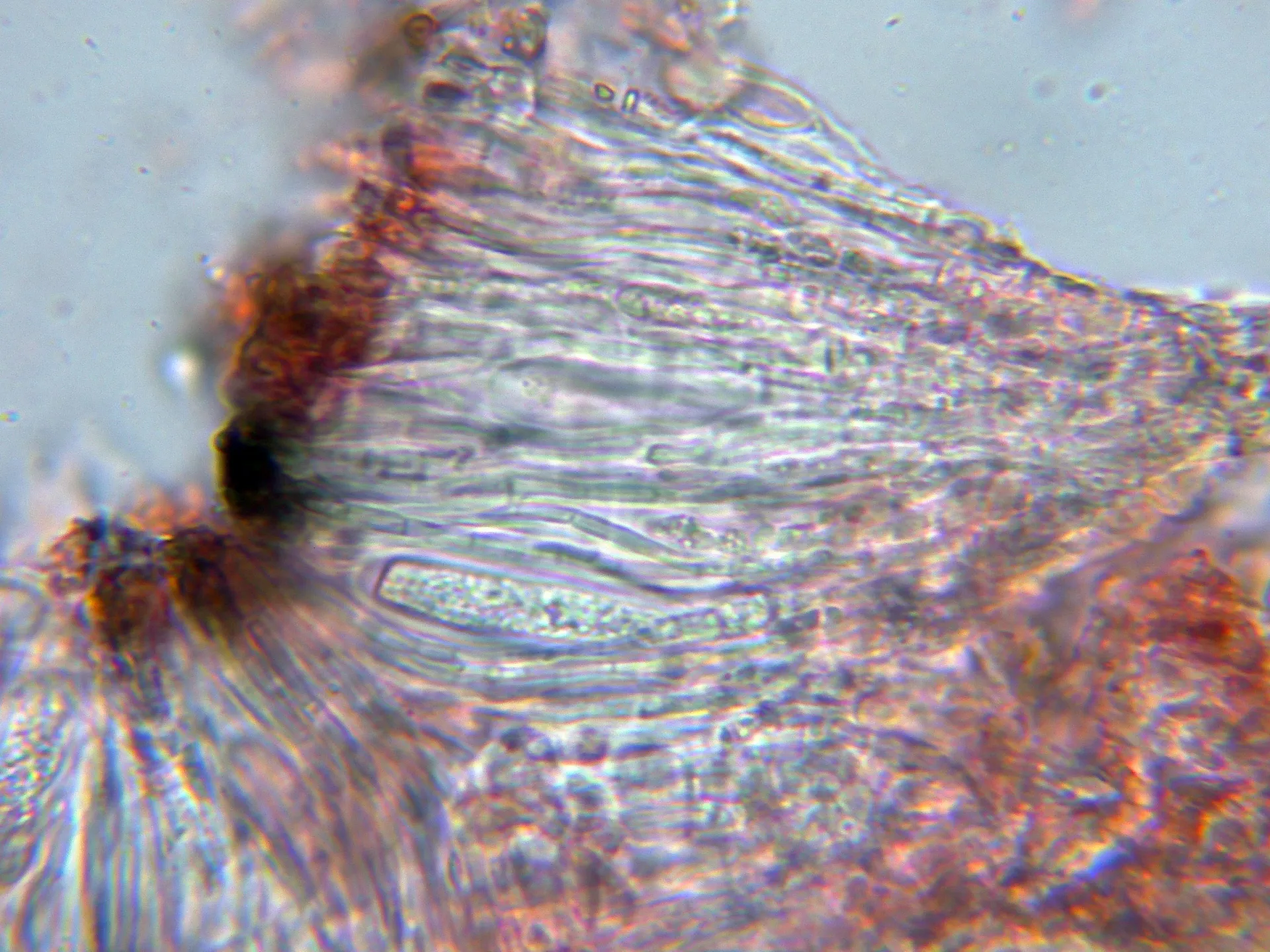 Microscopía de Porpidia crustulata - 10 - Himenio-003